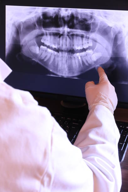Best Emergency Wisdom Teeth Removal in Lumber City, GA